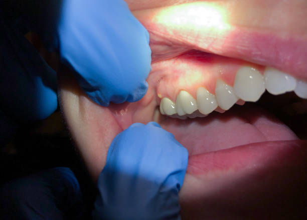 Best Pediatric Emergency Dentist in Timberne, LA